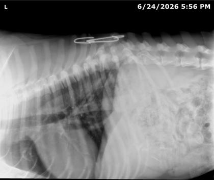 Radiografía lateral